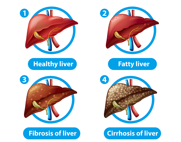 About Liver Disease